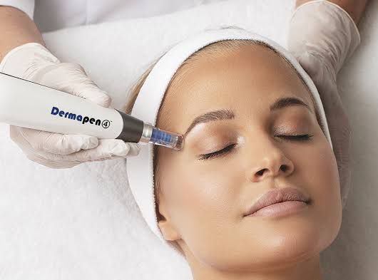 Reconstrução de Sobrancelhas